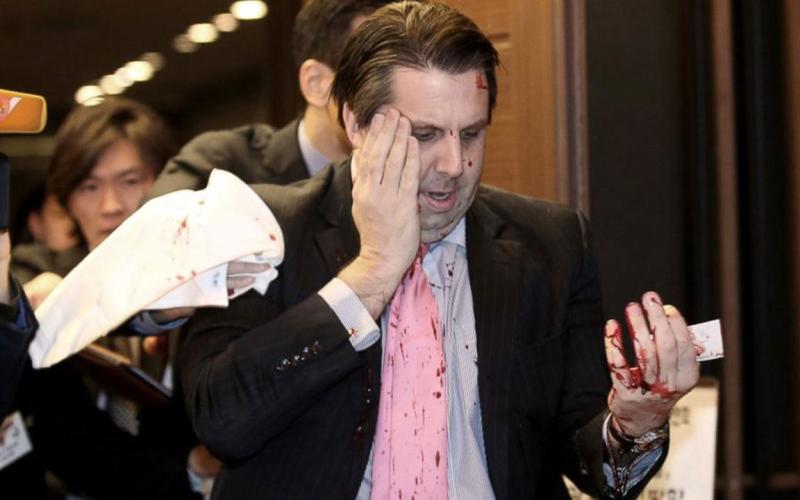 La Corée du Sud dénonce l'attaque de l'ambassadeur américain à Séoul