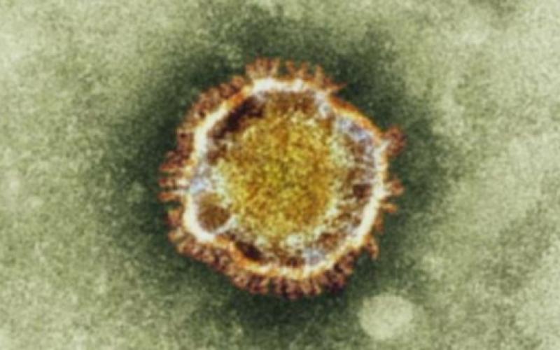 1er cas francais de coronavirus, proche du SRAS