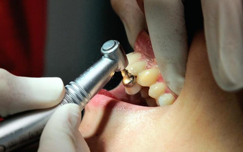 Marseille : un dentiste retrouvé égorgé dans son cabinet