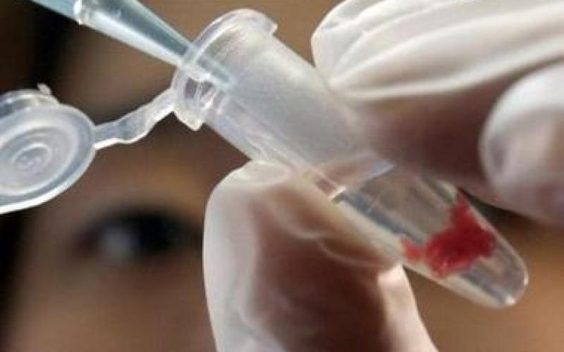 Nancy : un corps calciné retrouvé en forêt de Haye