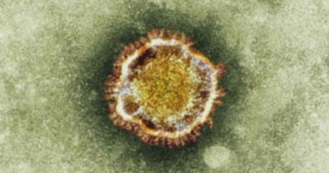 1er cas francais de coronavirus, proche du SRAS