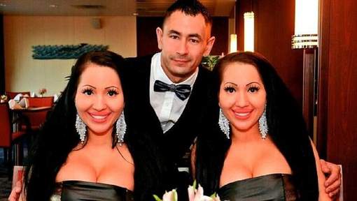 Ces jumelles partagent tout dans leur vie