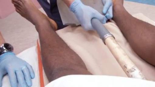 Il a un manche de pelle dans le rectum