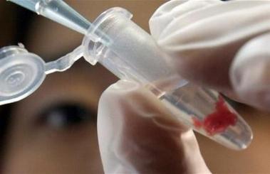 Nancy : un corps calciné retrouvé en forêt de Haye