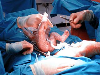 Un chirurgien oublie son mobile dans le ventre d'une patiente